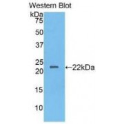 Western blot analysis of recombinant Chicken IL2.