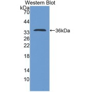 Western blot analysis of recombinant Rat IL4.