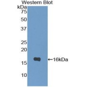 Western blot analysis of the recombinant protein.