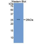 Western blot analysis of the recombinant protein.