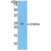 Western blot analysis of recombinant Sheep IL6.