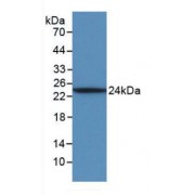 Western blot analysis of recombinant Sheep IL6.