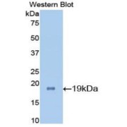 Western blot analysis of the recombinant protein.