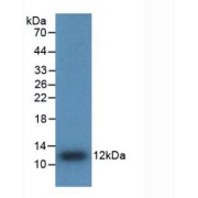 Western blot analysis of recombinant Human IL8.