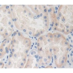 Interleukin 8 (IL8) Antibody