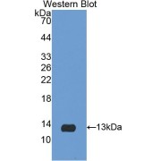 Western blot analysis of the recombinant protein.