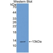 Western blot analysis of the recombinant protein.