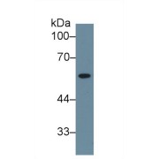 Western blot analysis of Human Liver lysate, using Human NEU Antibody (1 µg/ml) and HRP-conjugated Goat Anti-Rabbit antibody (<a href="https://www.abbexa.com/index.php?route=product/search&amp;search=abx400043" target="_blank">abx400043</a>, 0.2 µg/ml).