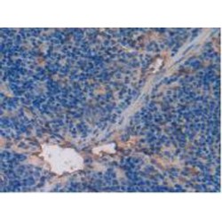 Thrombomodulin (THBD) Antibody