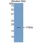 Western blot analysis of recombinant Human TTR.