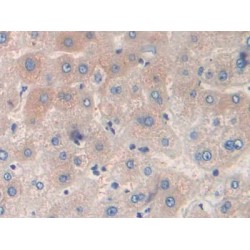 Transthyretin (TTR) Antibody