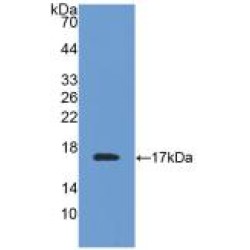 Transthyretin (TTR) Antibody