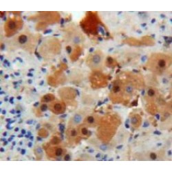 Transthyretin (TTR) Antibody