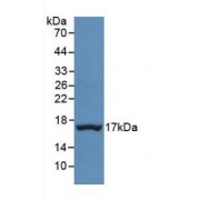 Western blot analysis of recombinant Human TTR.