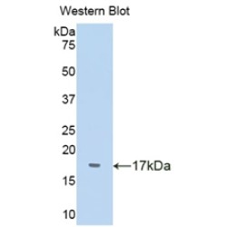 Transthyretin (TTR) Antibody