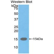 Western blot analysis of the recombinant protein.