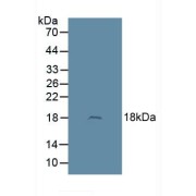 Western blot analysis of Rat Brain Tissue.