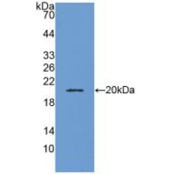 Adrenomedullin (ADM) Antibody