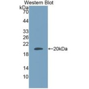 Western blot analysis of recombinant Human ADM.