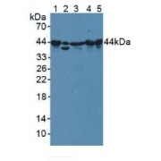 Western blot analysis of (1) Mouse Serum, (2) Human A549 Cells, (3) Mouse Spleen Tissue, (4) Mouse Heart Tissue and (5) Rat Heart Tissue.
