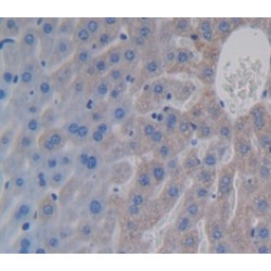 Erythropoietin (EPO) Antibody