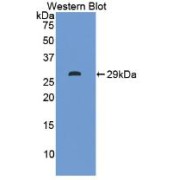 Western blot analysis of recombinant Human ITLN1 Protein.