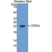 Western blot analysis of the recombinant protein.