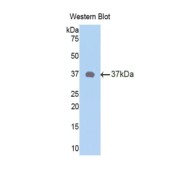 Western blot analysis of the recombinant protein.