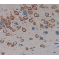 Neuropeptide Y (NPY) Antibody