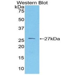 Prion Protein (PRNP) Antibody