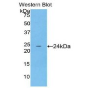 Western blot analysis of the recombinant protein.