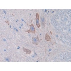 Spectrin Alpha Chain, Non-Erythrocytic 1 (SPTAN1) Antibody