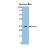 Western blot analysis of the recombinant protein.