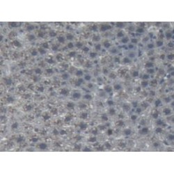 Angiotensinogen (AGT) Antibody