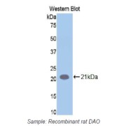 Western blot analysis of the recombinant protein.