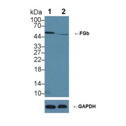 Fibrinogen Beta (FGB) Antibody