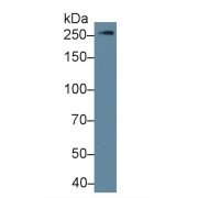 Western blot analysis of Human Lung lysate, using Human FLNb Antibody (1 µg/ml) and HRP-conjugated Goat Anti-Rabbit antibody (<a href="https://www.abbexa.com/index.php?route=product/search&amp;search=abx400043" target="_blank">abx400043</a>, 0.2 µg/ml).