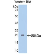 Western blot analysis of the recombinant protein.