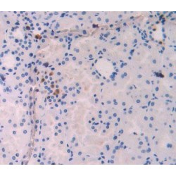 Interleukin 18 (IL18) Antibody