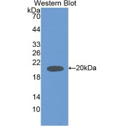 Western blot analysis of recombinant Rat IL18.