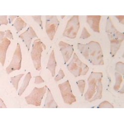 Interleukin 18 (IL18) Antibody