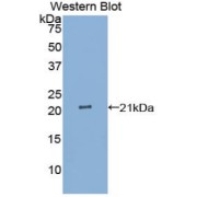 Western blot analysis of the recombinant protein.