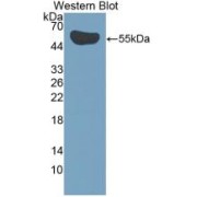 Western blot analysis of recombinant Human IL35 Protein.