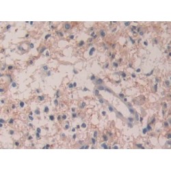 Interleukin 35 (IL35) Antibody