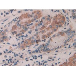 Interleukin 35 (IL35) Antibody