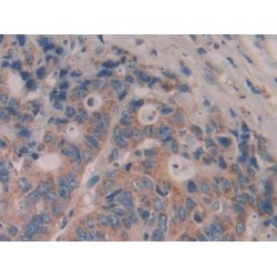 Interleukin 35 (IL35) Antibody