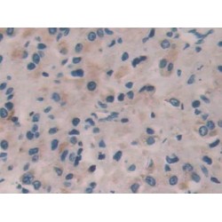 Interleukin 35 (IL35) Antibody