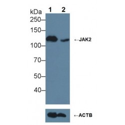 Tyrosine-Protein Kinase JAK2 (JAK2) Antibody
