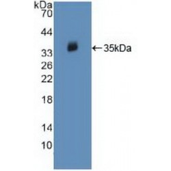 Tyrosine-Protein Kinase JAK2 (JAK2) Antibody
