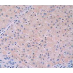 Tyrosine-Protein Kinase JAK2 (JAK2) Antibody